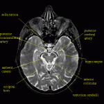 Brain Health